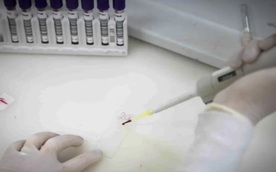 Secretaria de Saúde de SP investiga novo caso suspeito de ebola