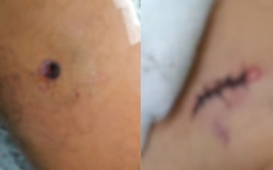 'Me afoguei no pr&oacute;prio sangue', diz sargento ferido em confronto policial em MS
