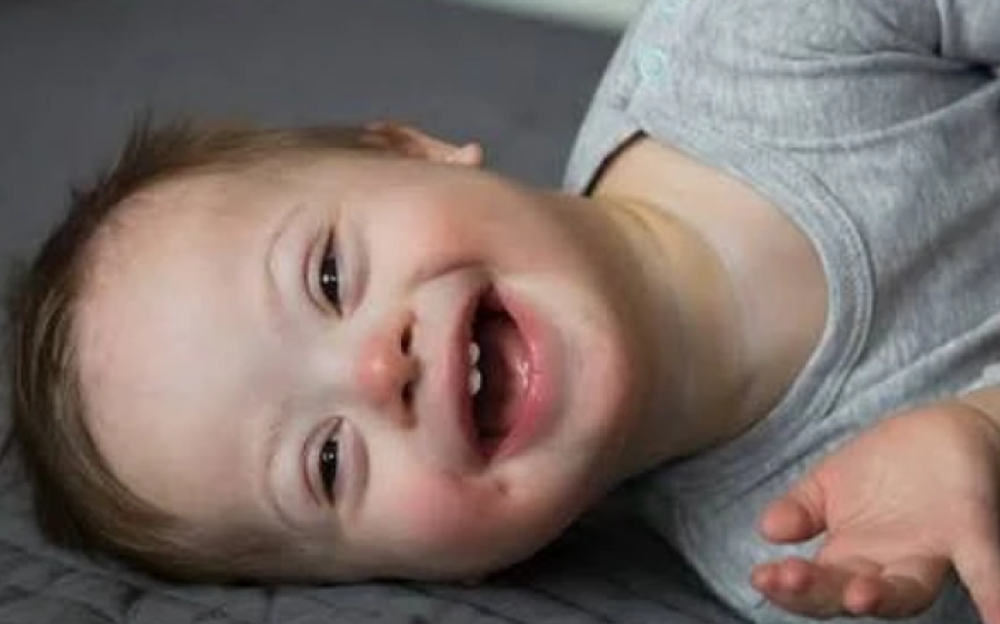Curso gratuito da SES capacita famílias e profissionais para o cuidado à pessoa com síndrome de Down