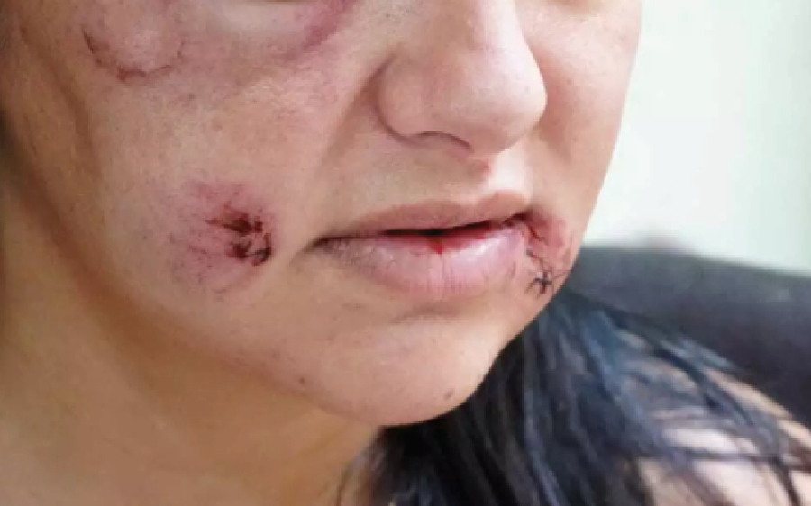 Violência contra a mulher avança em Mato Grosso do Sul e lesões em ambiente doméstico crescem 20%