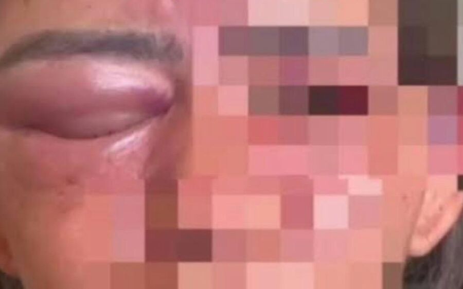 Jovem denuncia companheiro: violência dentro de casa termina com prisão em Coxim 
