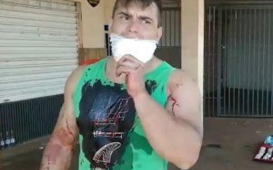 Ciclista é baleado em atentado na Capital 