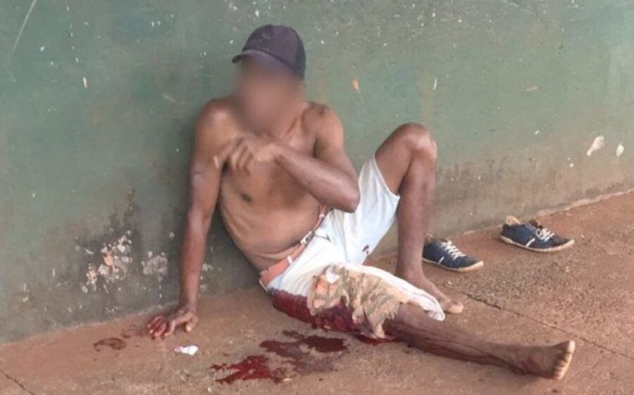 Mulher esfaqueia o marido na perna após briga por causa de droga