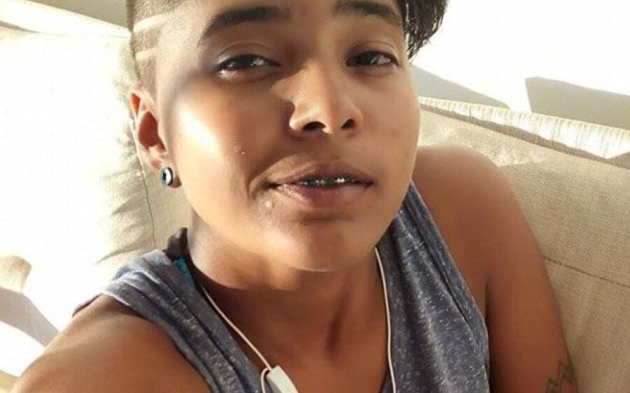 Moradora de Coxim segue  internada na UTI da Santa Casa na Capital após grave acidente