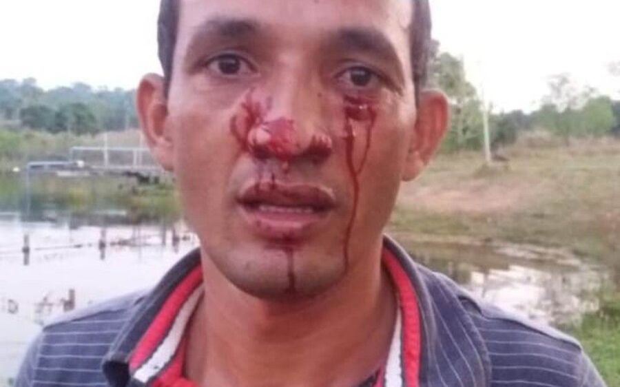 Empresário é atacado no rosto por sucuri de 3  metros durante pescaria