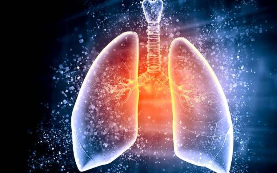 Radiocirurgia é eficaz contra câncer de pulmão, diz estudo brasileiro