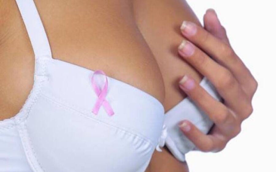 Câncer de mama, várias doenças em uma