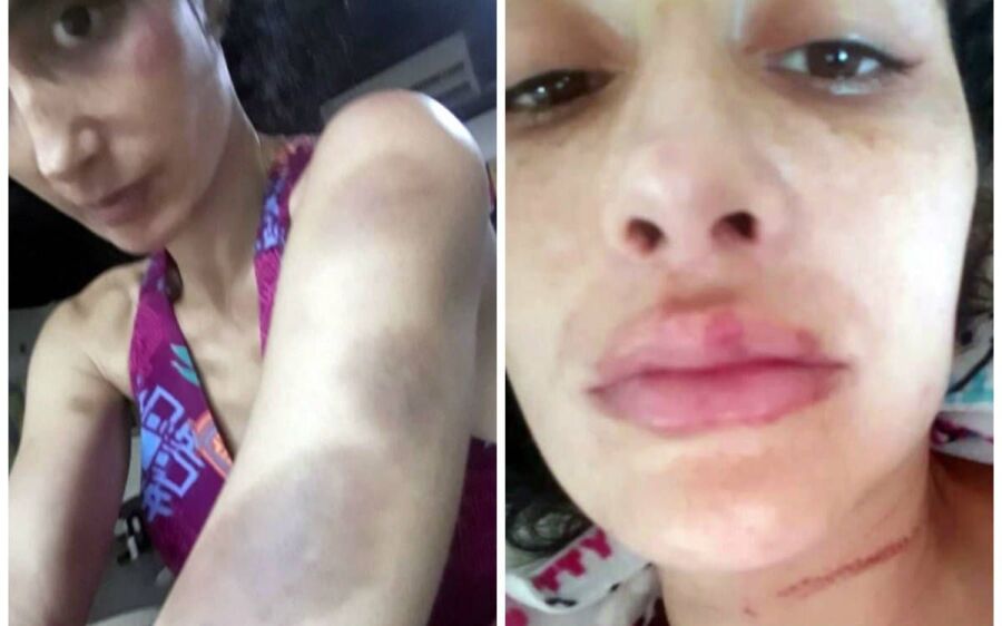 Ex-atriz da Globo Cristiane Machado fala sobre prisão do marido que a espancou