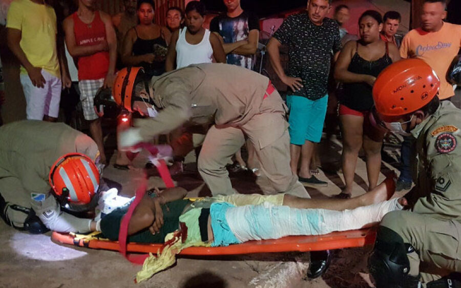Motociclista tem perna dilacerada ao colidir em caçamba em avenida de Coxim