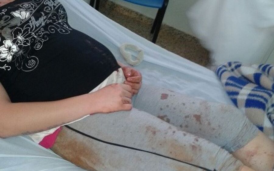 Grávida perde bebê depois de negar relações sexuais e ser espancada pelo marido