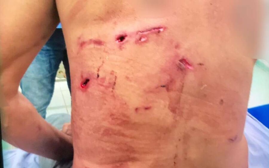 Homem atacado por onça-pintada é salvo por 5 cachorros em MS