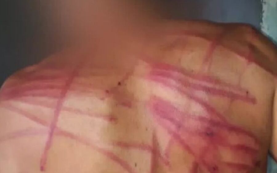 Adolescente morre após ser brutalmente chicoteado em MS