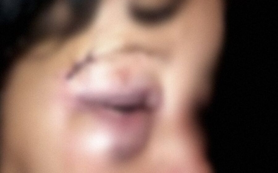 Filho chama polícia depois de mulher desmaiar ao ser espancada com socos pelo marido