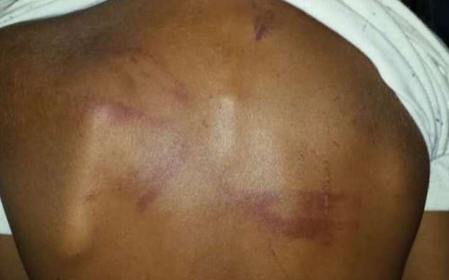 Mãe é presa por suposta tortura contra filho de 4 anos em MS; vítima estava trancada em quarto e com