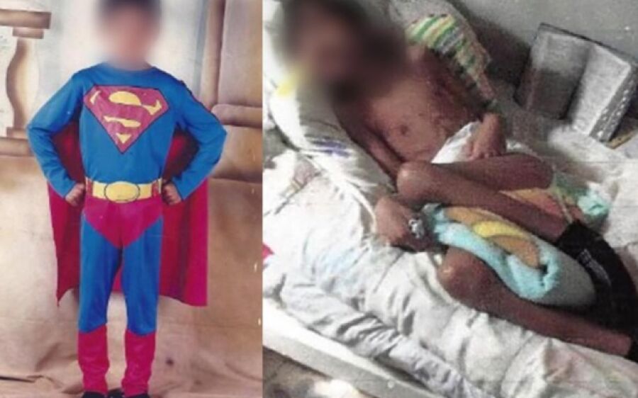 Por erro médico, hospital pagará R$ 200 mil a menino que vegeta há 8 anos
