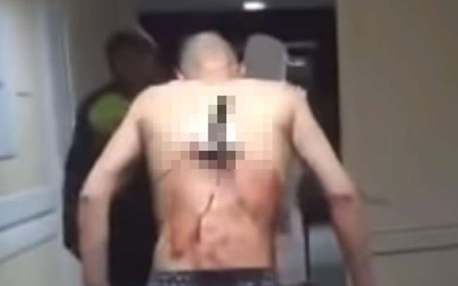 Um homem ainda não identificado foi esfaqueado e ficou com um punhal cravado nas costas na madrugada