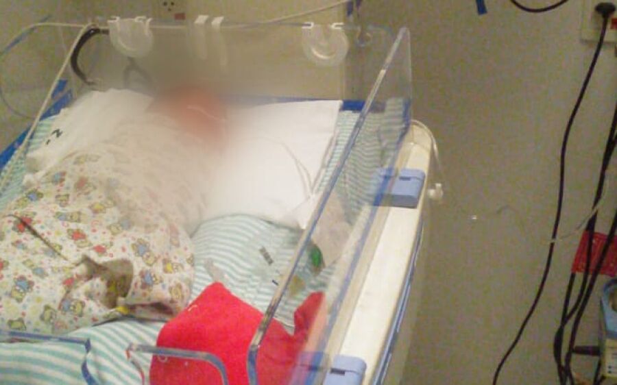 Bebê que nasceu sem ânus passa por cirurgia no HRMS
