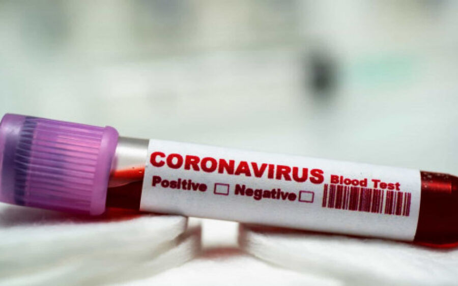 Brasil tem 1º resultado positivo para coronavírus