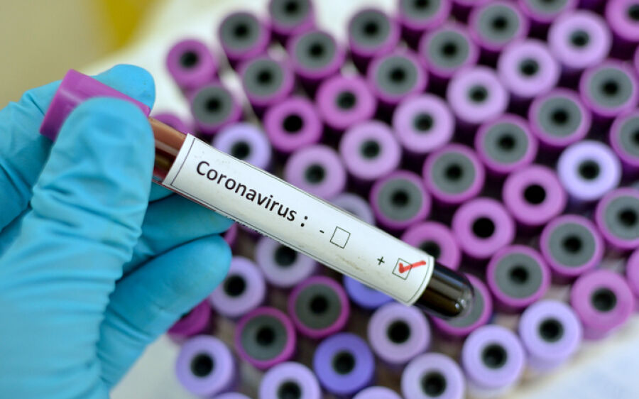 Além dos dois casos confirmados, MS tem quatro suspeitos do novo coronavírus, aponta SES