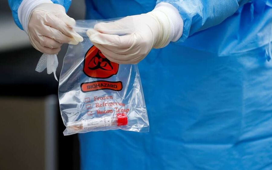 Covid-19: 500 mil kits de teste rápido chegam ao Brasil