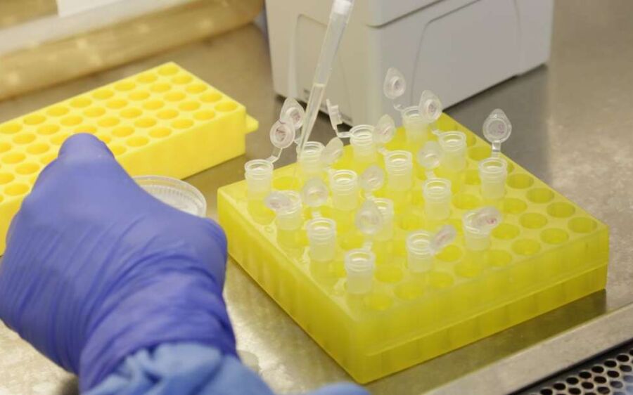 Coronavírus: MS registra 115 casos confirmados, em 24 horas 62 testes dão negativos