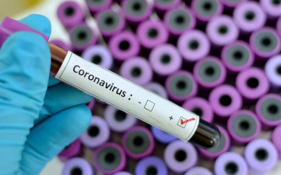 Infectado com Coronavírus teve contato com dezenas de pessoas e circulou em Coxim