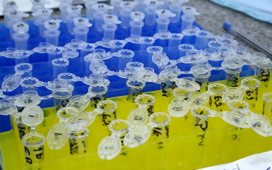 Com mais 156 confirmados, Mato Grosso do Sul passa para 1.802 pacientes com coronavírus