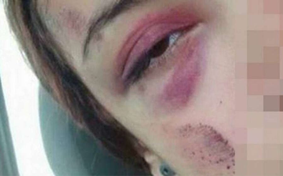 Jovem é espancada em festa do corona ao tentar defender amiga bêbada de ser abusada