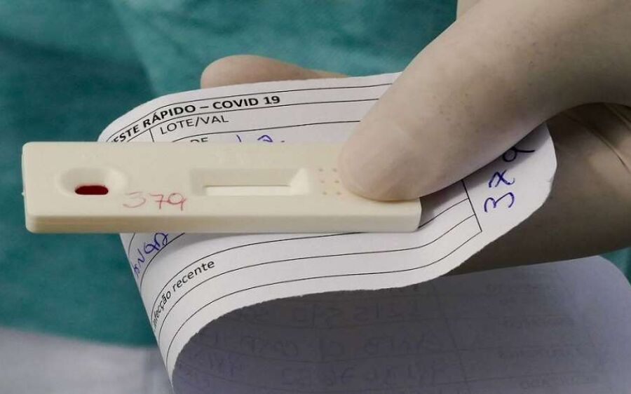 Saiba quais são os tipos testes existentes de Covid-19