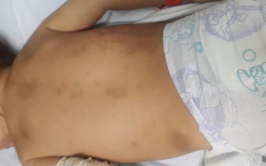 Adolescente é  preso após estrangular bebê por não  suportar o choro