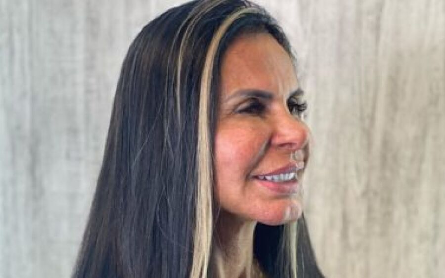 Gretchen tira pedaço do lábio em novo procedimento estético