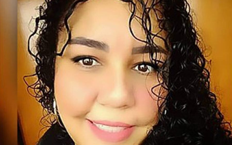 Mulher tem reação alérgica gravíssima depois de pintar o cabelo