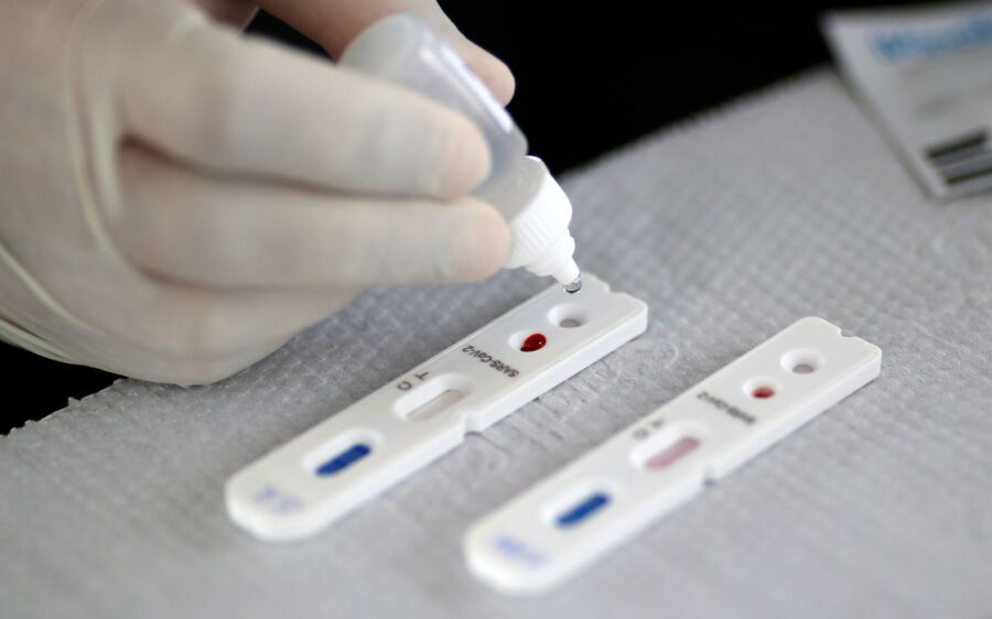 Saúde realiza testes de Covid no distrito de Jauru