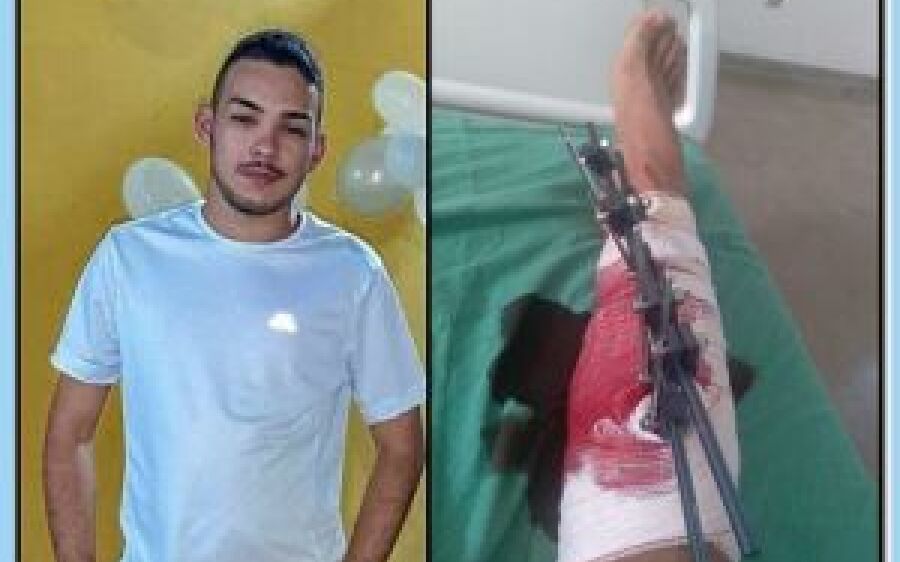 Após acidente, jovem de Coxim realiza 