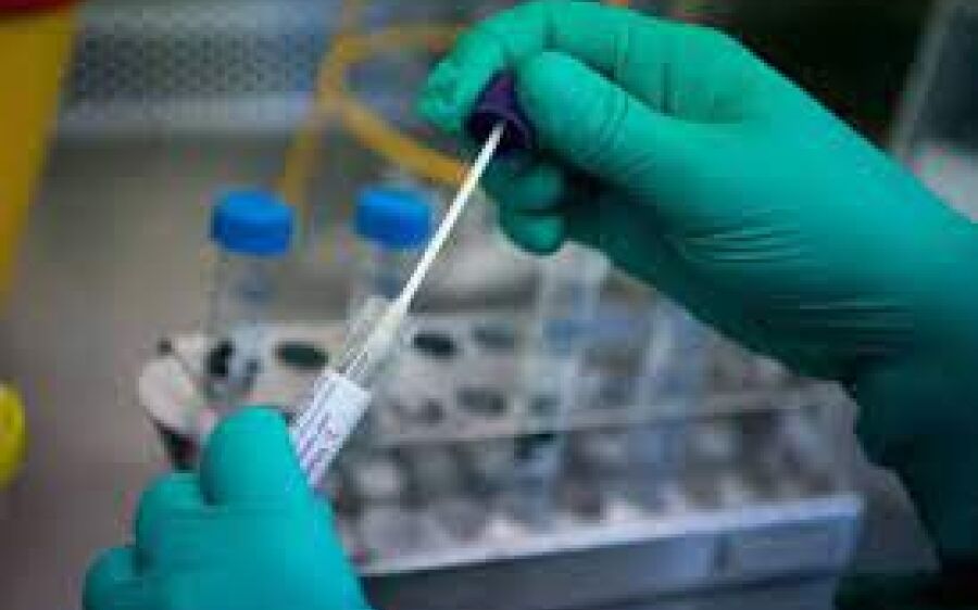 MS tem 57 mortes e 1.037 novos casos de coronavírus em 24 horas