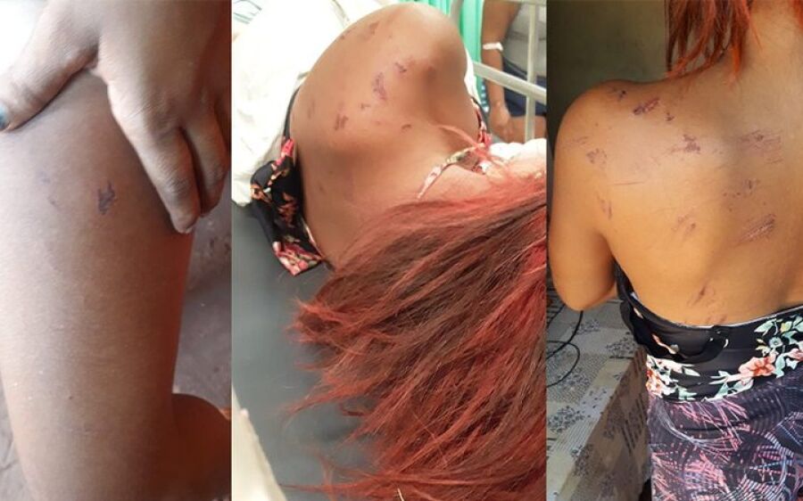 Adolescente de 14 anos é arrastada e atropelada após mulher desconfiar de suposto caso de marido