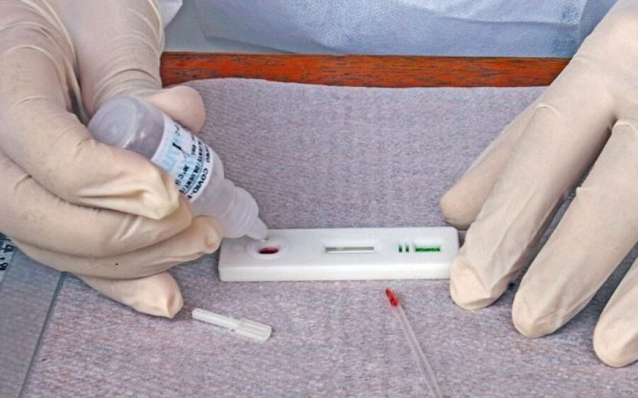 Covid-19: casos ativos e mortes voltam a subir e Coxim entra em alerta 