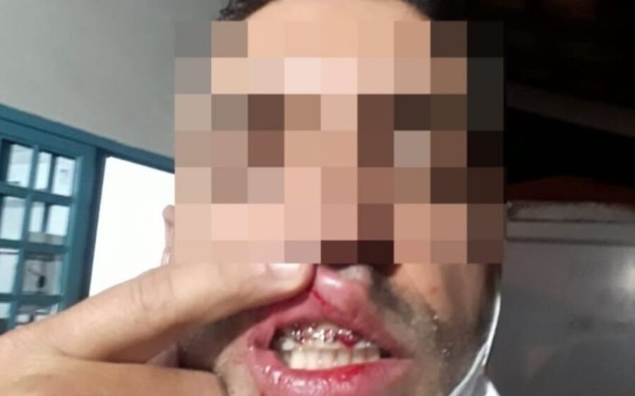 Agente da fiscalização sanitária da Covid é agredido ao fiscalizar em conveniência
