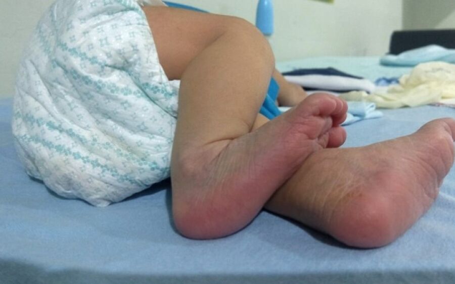 Covid - bebê de 9 meses está entre os 27 óbitos confirmados em MS