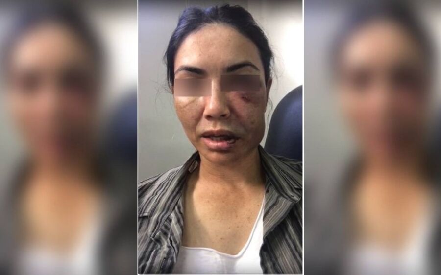 Motorista de app fingiu estar morta após ser espancada e jogada de cima de ponte no MT