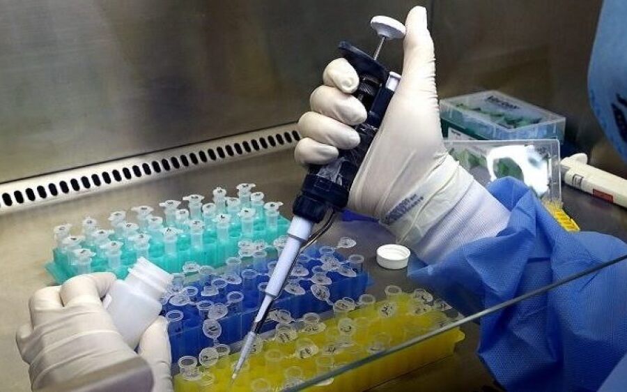 Agosto registra menor número de mortes e casos por covid no ano em MS