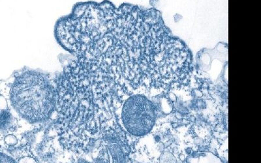 Índia: Vírus Nipah causa morte de menino de 12 anos e preocupa autoridades de saúde