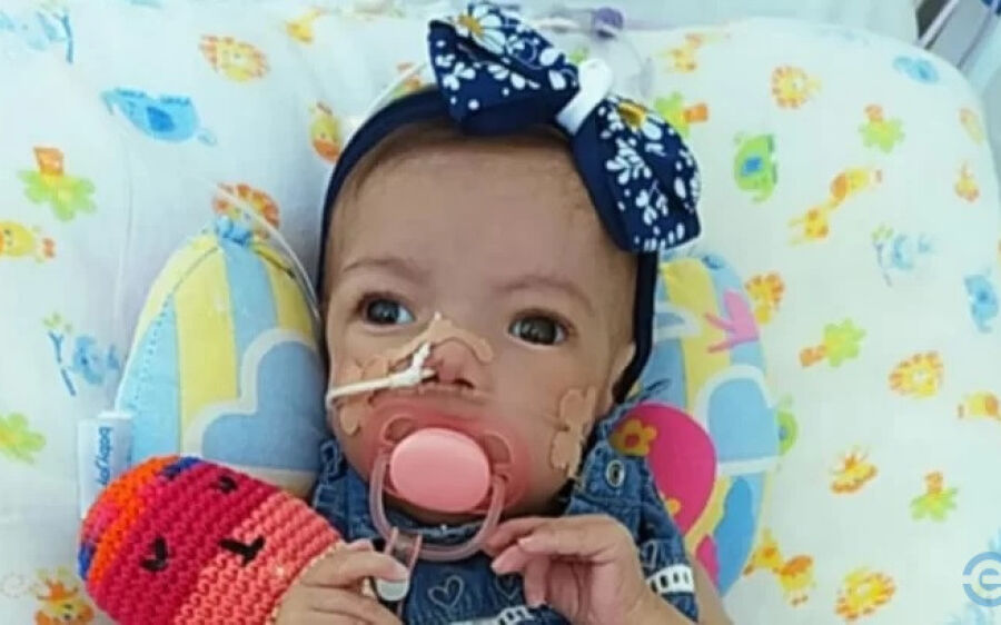 Família faz Vakinha para manter Lívia em casa, bebê de Coxim tem doença rara e sem cura