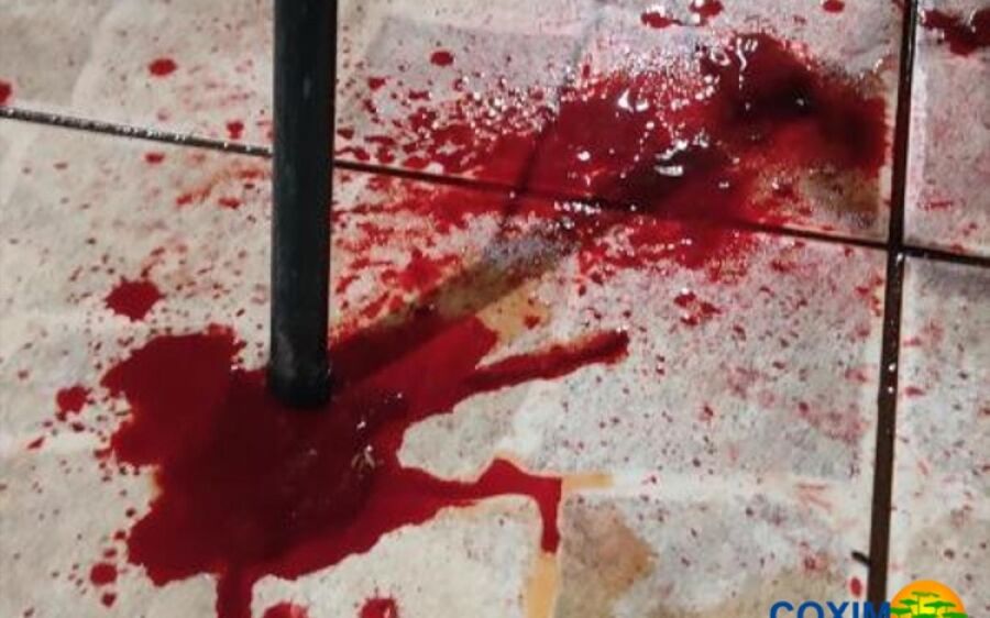 Homem fica ferido na cabeça após ser empurrado por amigo na Vila Bela