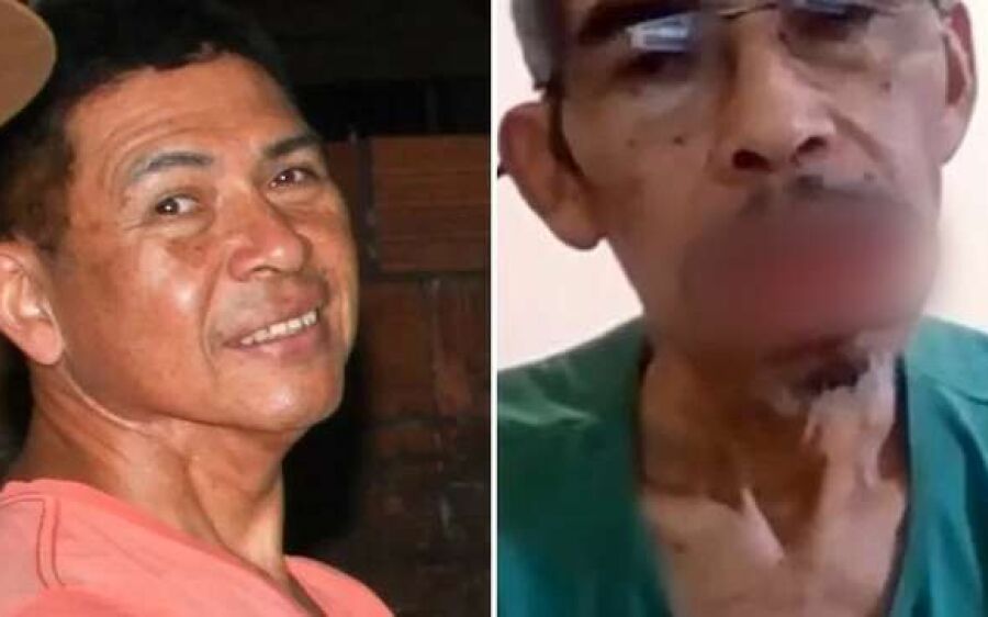 Pastor vê câncer tomar fígado e pulmões e esperança é tratamento caro fora de Campo Grande