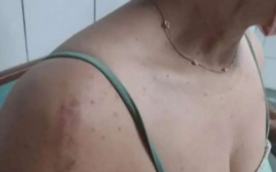 Marido bate na esposa por fazer arroz e feijão para o jantar