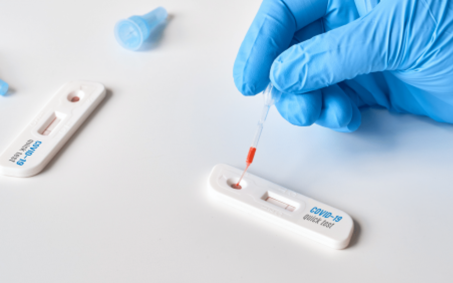 De olho no preço dos testes de Covid, Procon de Coxim emite recomendação