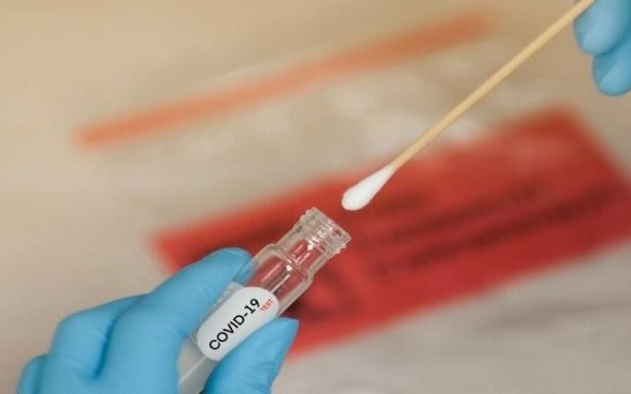 Aquidauana começa a realizar testes de covid nos postos de saúde