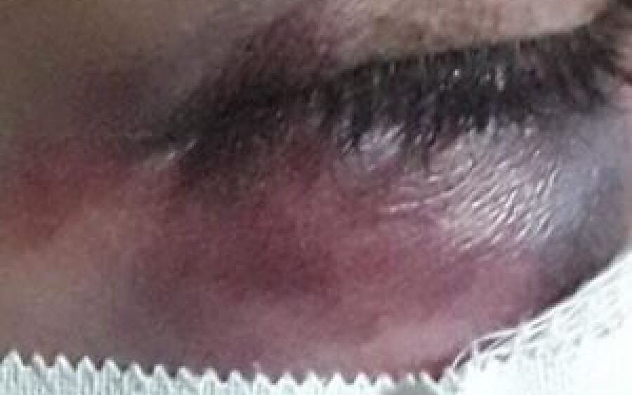 Mulher é socorrida com maxilar quebrado após ser espancada por marido que é preso pela PM