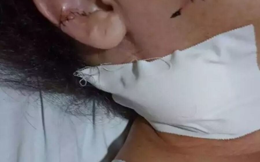 ´Foi horroroso, desesperador´, diz motorista de aplicativo esfaqueada 15 vezes